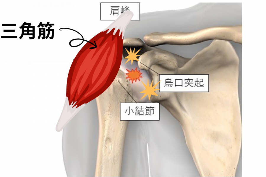 三角筋による肩関節の詰まり